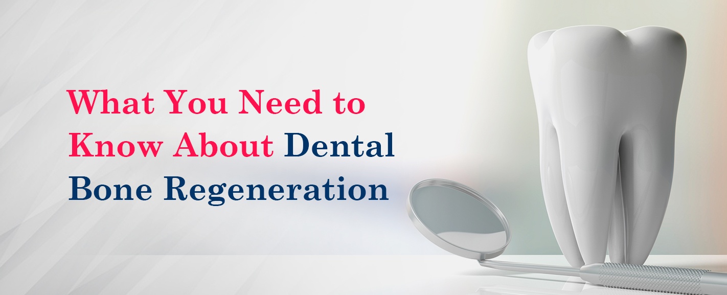 What To Know About Dental Bone Regeneration and Grafting Hiossen