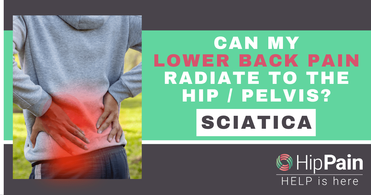 Can My Lower Back Pain Radiate to the Hip or Pelvis Sciatica, Referred