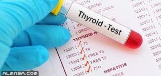 كم مدة تحليل الغدة الدرقية