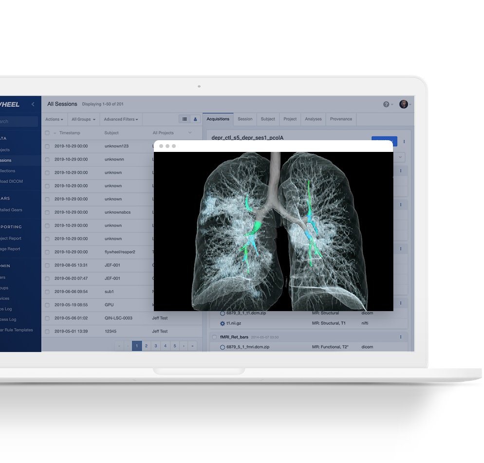 Flywheel Nabs 15M for NextGen Informatics Platform for Medical