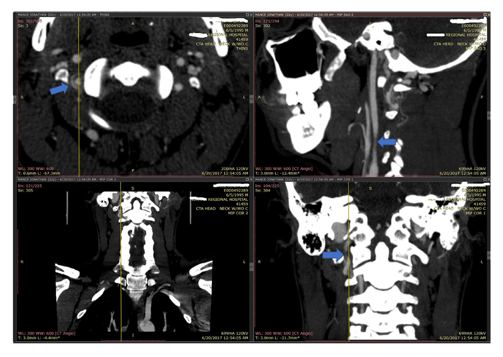 Radiology Errors Heather J. Mitchell Law