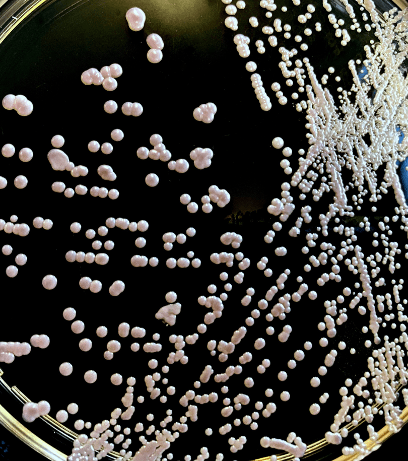 Common Breast/Feeding Concerns HealthUnit HaldimandNorfolk