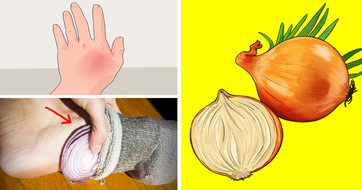 5 Home Remedies An Onion Can Solve Holistic Living Tips