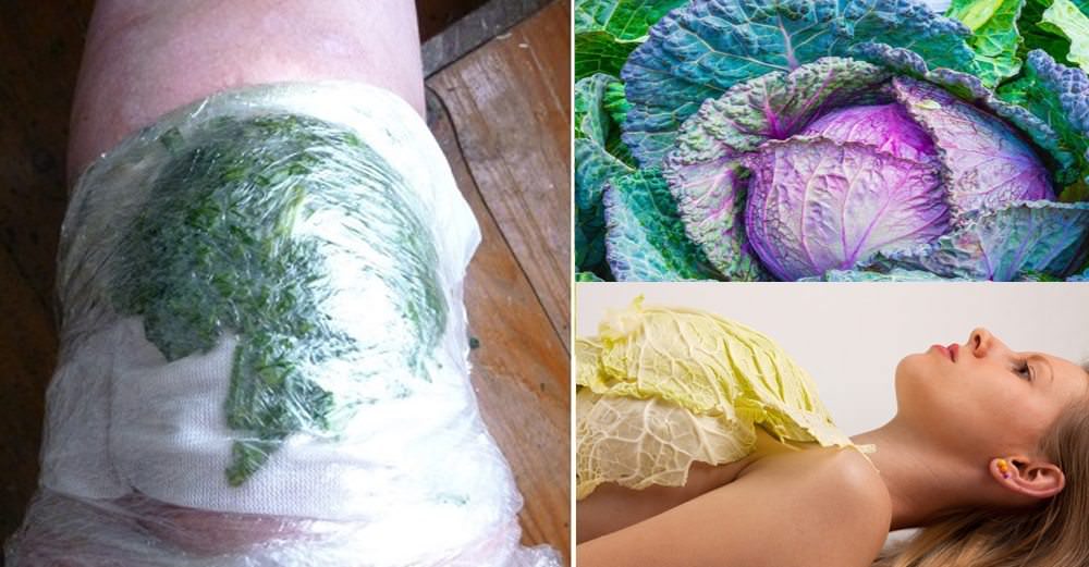Try this Cabbage Compress for Pain, and More! Holistic