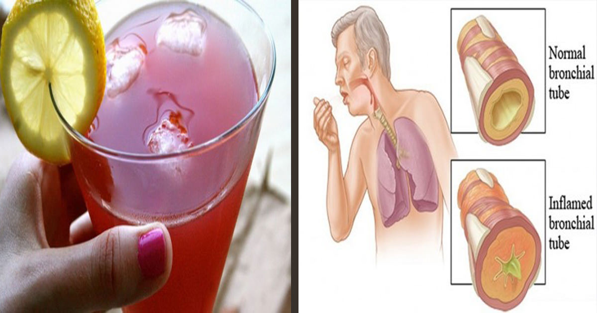 Get Rid of Mucus Congestion and Sinus Problems with this