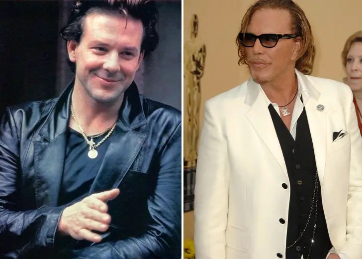 What Happened To Mickey Rourke? Plastic Surgery Explained