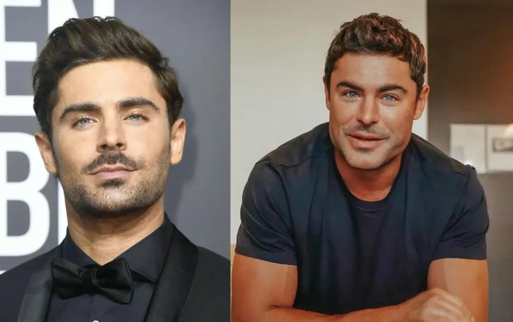 Zac Efron Before and After The Accident
