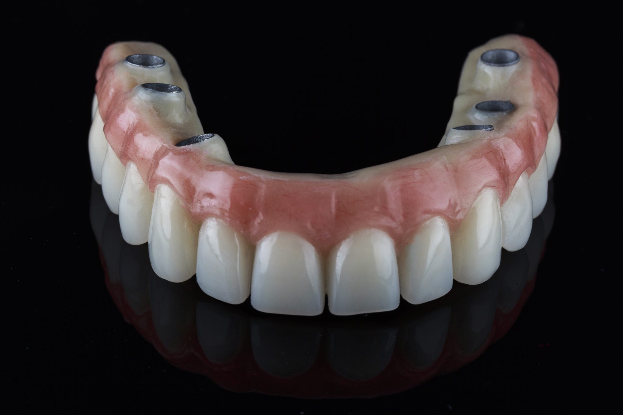 Implant Dentures Everything You Need To Know Holt Dentures