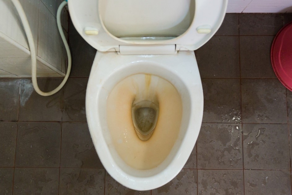 How to Remove Yellow Stains from Toilet Step by Step Guide Home