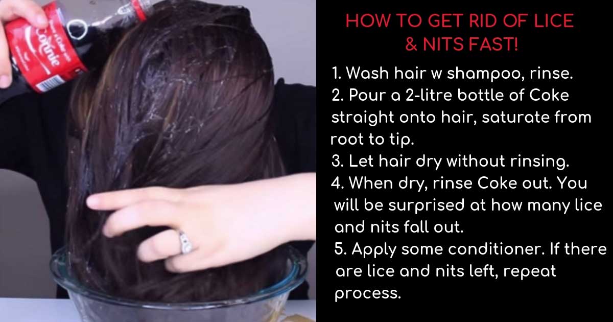 How To Get Rid Of Lice And Nits Fast