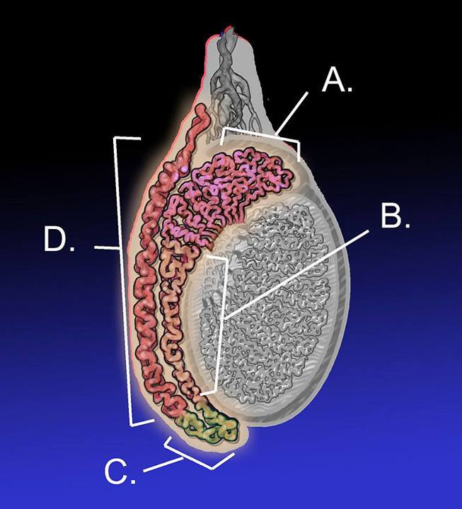 Case Report Antibiotic Resistant Epididymal Abscess