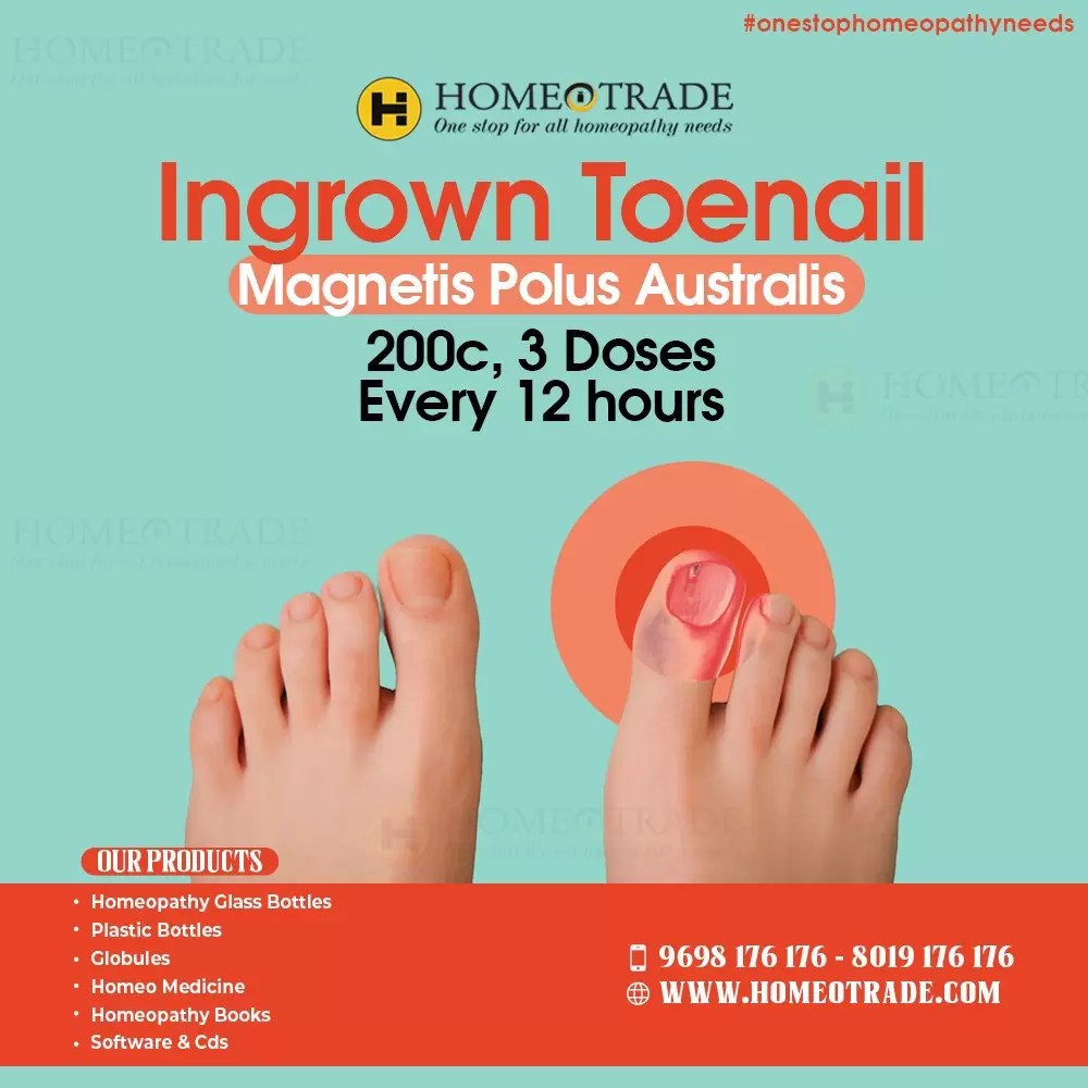 Ingrown toenail HomeopathyHomeopathy near me Homeotrade