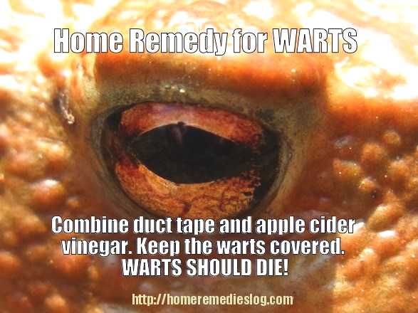 Home Remedies for Warts Effective Natural Removal Methods