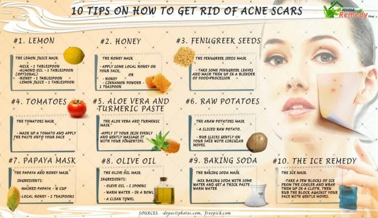 10 Tips on How to get Rid of Acne Scars Home Remedies