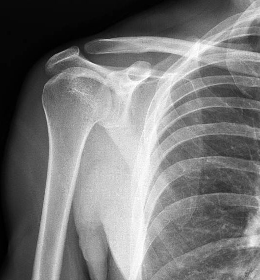 Home x ray service in chennai home physiotherapy service in chennai