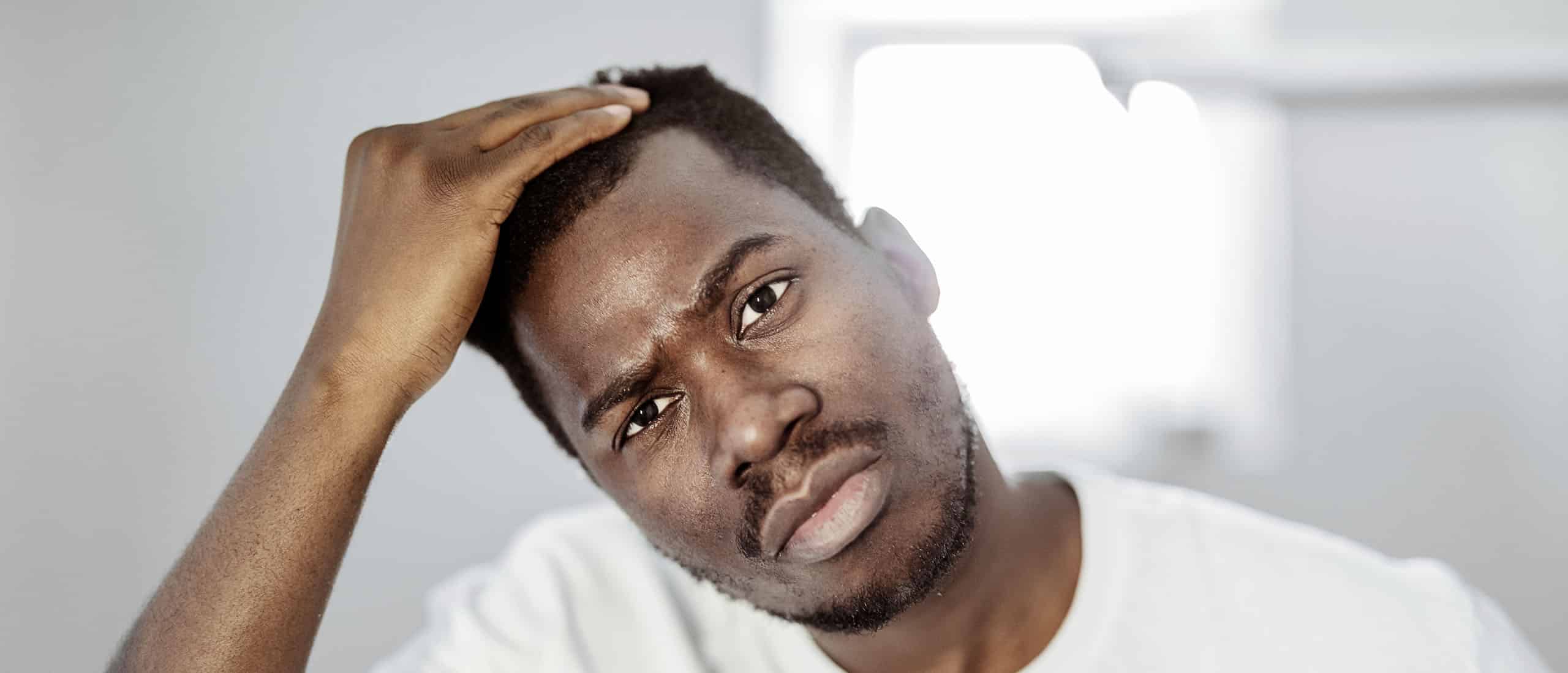 Testosterone and Hair Loss Is There a Connection?