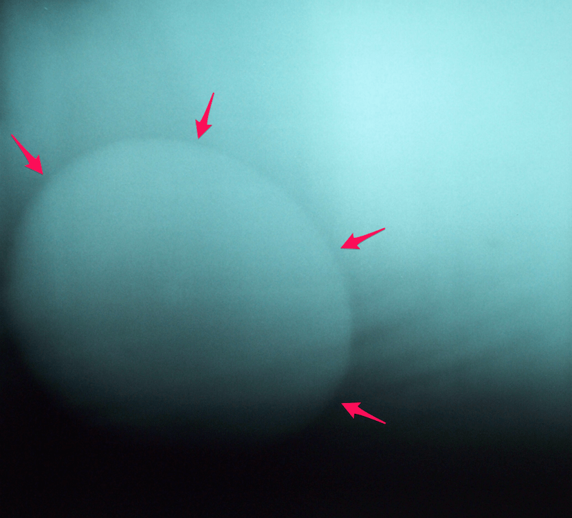 Enteroliths, Intestinal Stones Horse Side Vet Guide