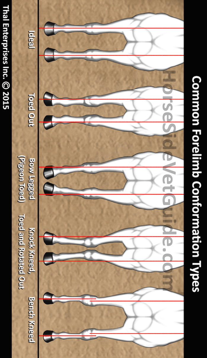 Pigeon Toed And Knock Kneed