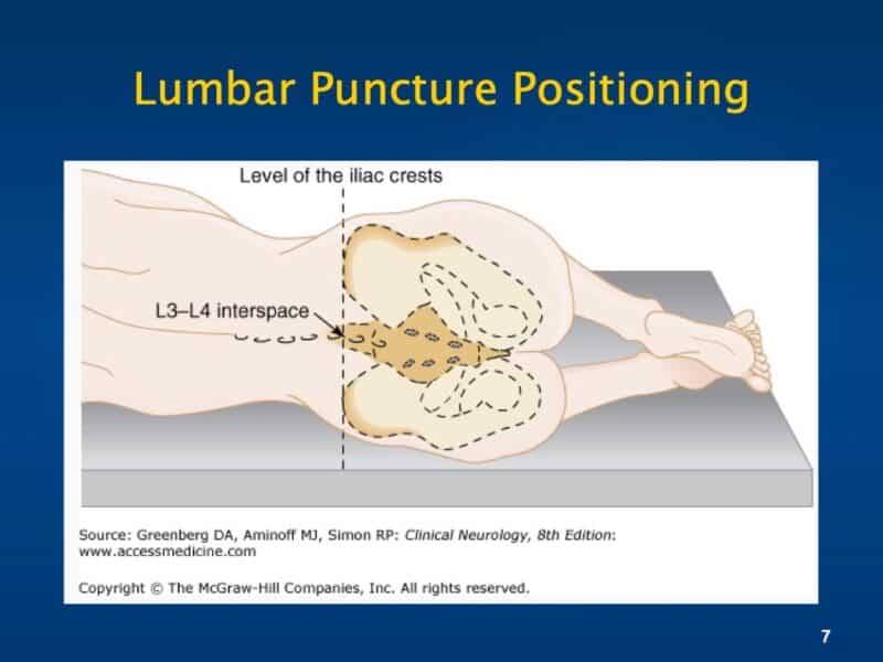 LUMBAR PUNCTURE COURSE Hospital Procedures Consultants