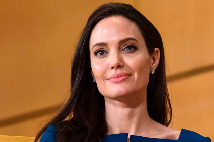 All About Facial Paralysis Top Celebrities Journey With Bell’s Palsy