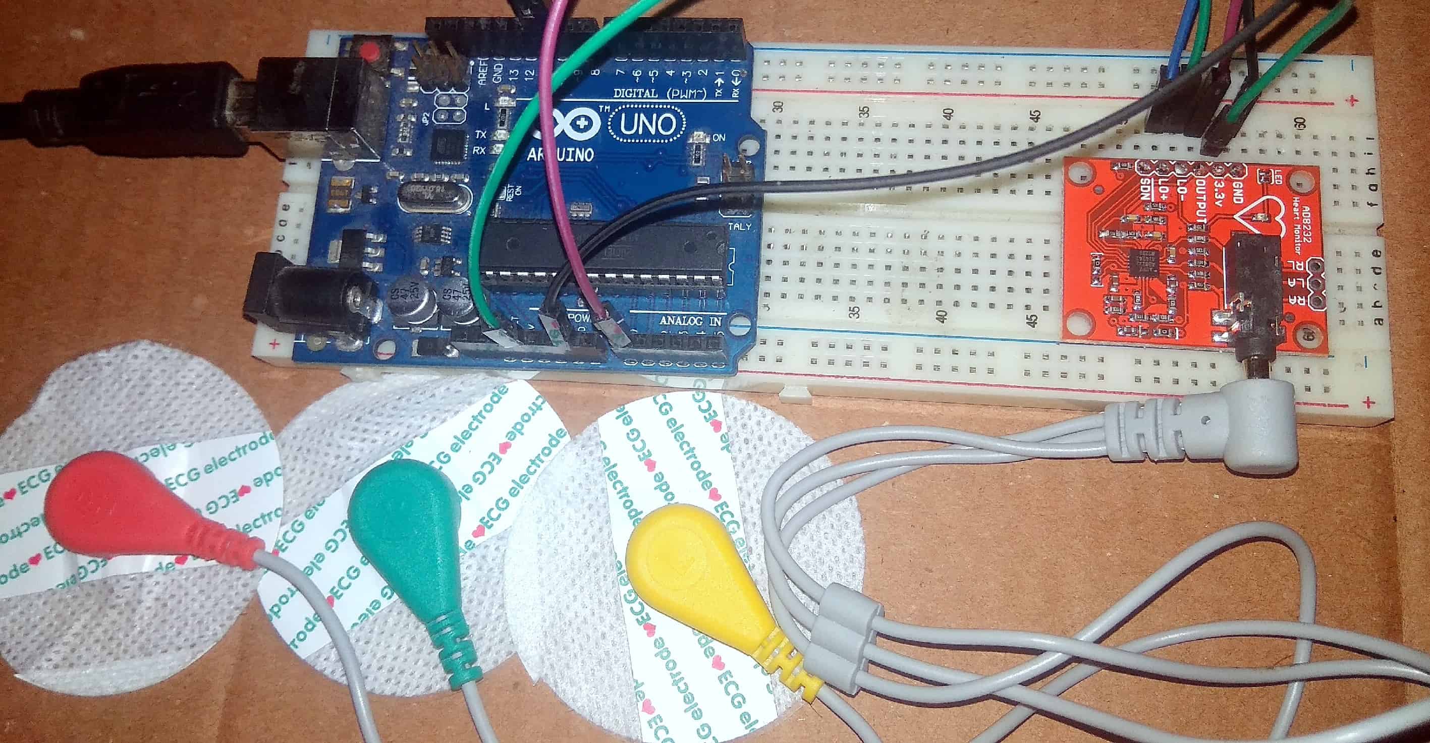AD8232 ECG Sensor & Arduino Interfacing with ECG Graph