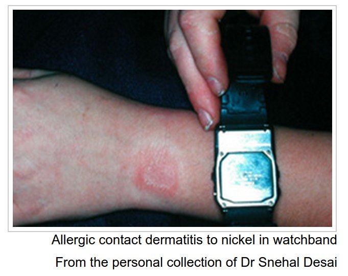 Feel the burn? Apple Watches ignite a heated debate online. How2Med