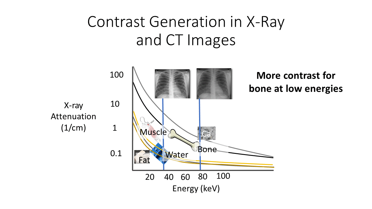 XRay Transmission Calc How Radiology Works
