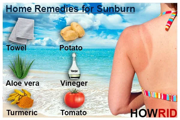 How to Get Rid of Sunburn Fast?
