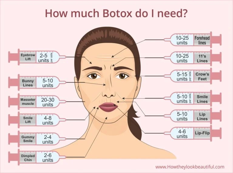 Botox Around MouthSay Goodbye to Wrinkles (Does it Work?)
