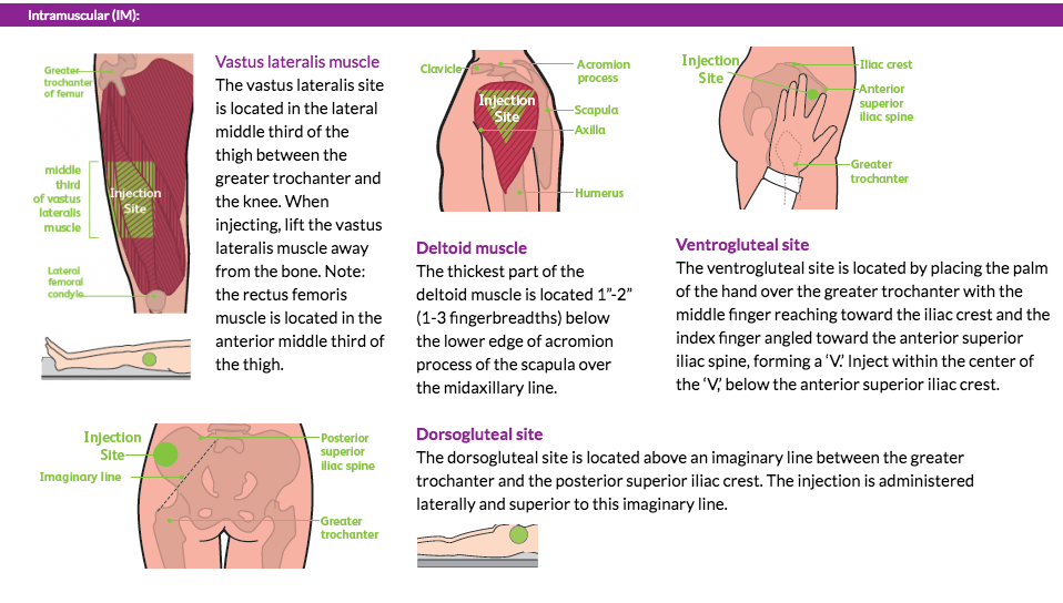 Injection Sites •