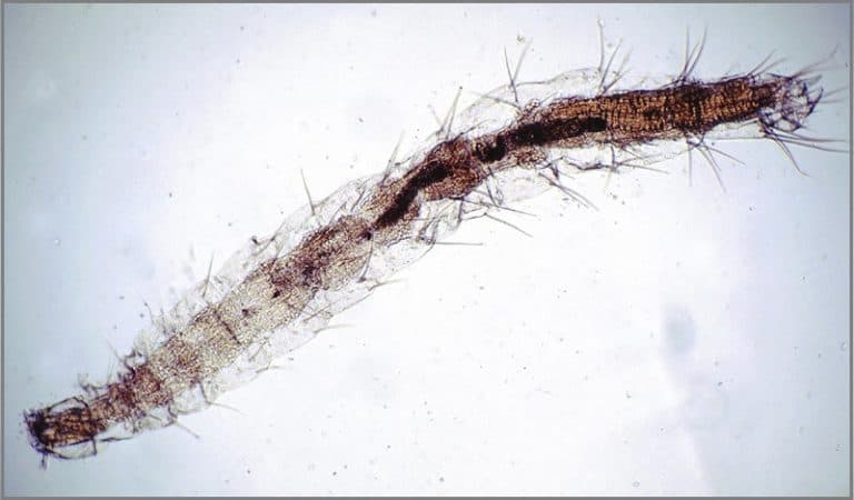 6 Signs Of Fleas In Bed You Can Easily Ignore