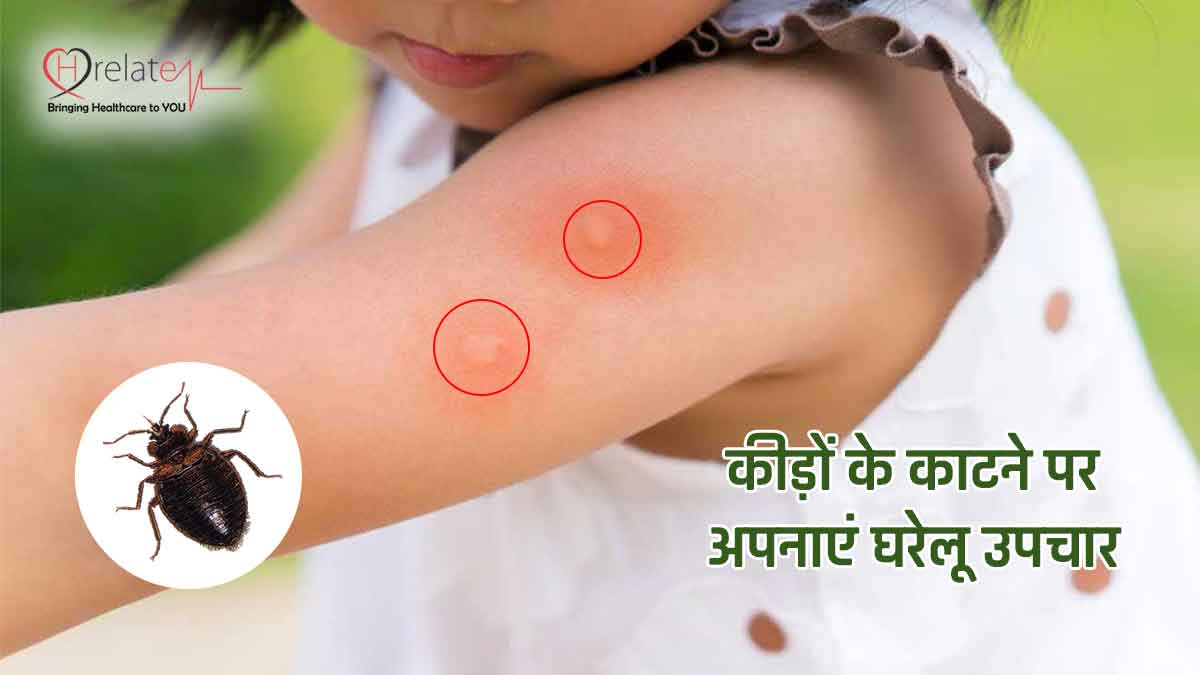 Home Remedies For Insect Bite कीड़े के काटने से हो सकती है परेशानी