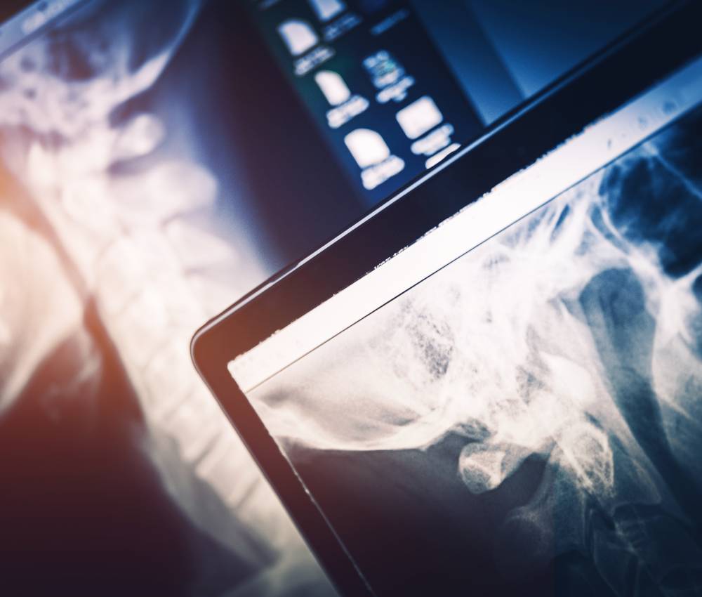 Homepage Hackensack Radiology