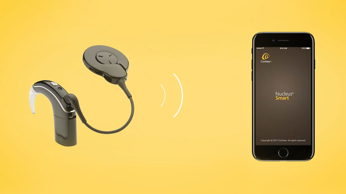 Cochlear Nucleus® 7 Cochlear Implant Product Info, Reviews, Prices