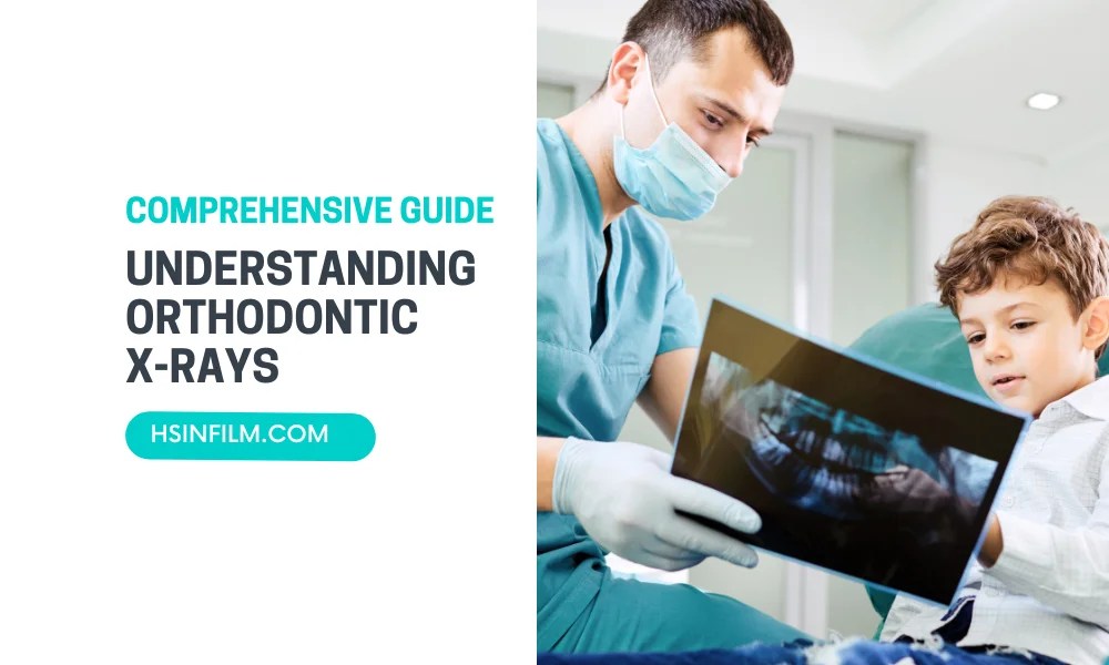 Understanding Orthodontic XRays A Comprehensive Guide HSIN FILM