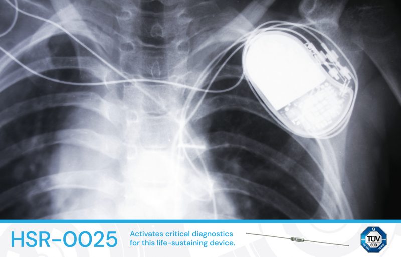 A Pacemaker Success Story HSI Sensing