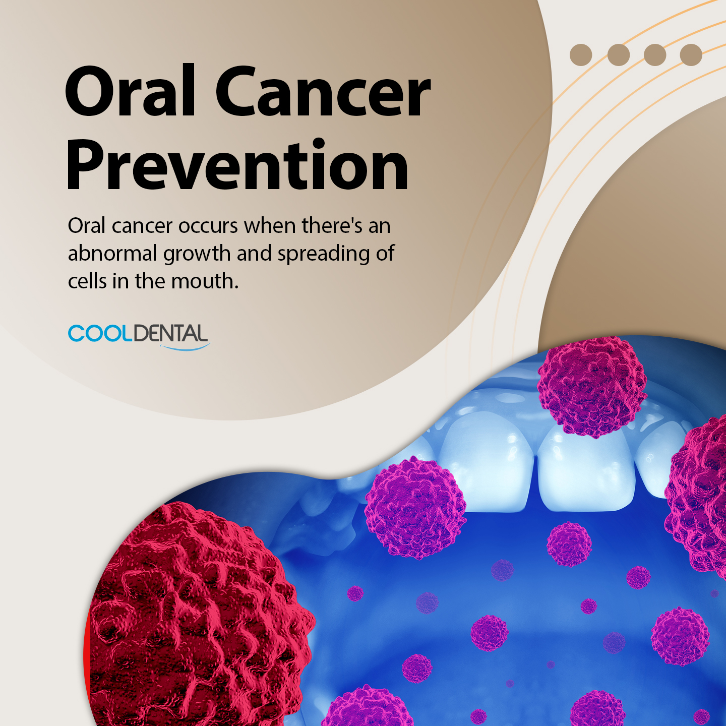 Oral Cancer Prevention