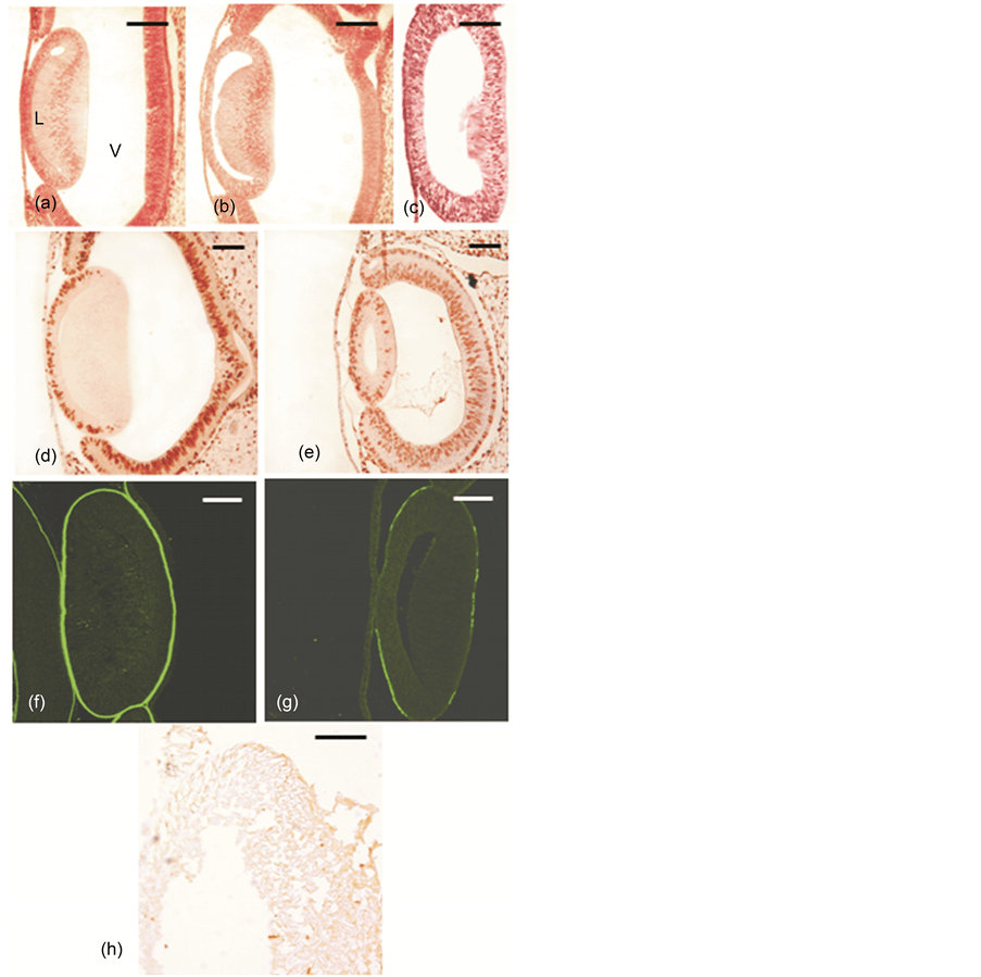 Lens Capsule HSPGPerlecan Regulates Lens Fibre Differentiation during