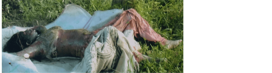 The Corpse Is a Silent Witness Who Never Lies—A Case Report