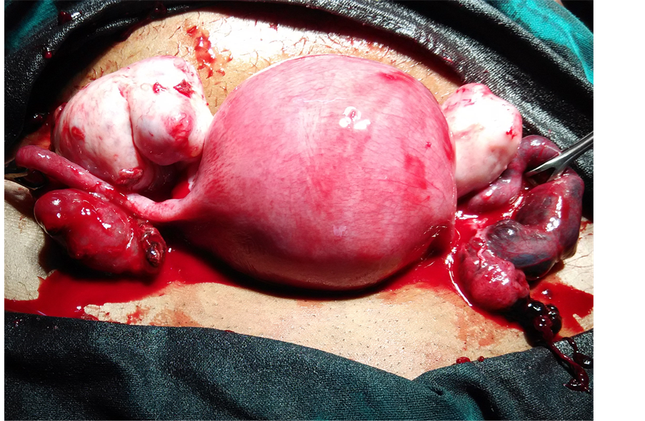 Heterotopic Pregnancy Challenges in Diagnosis and Management