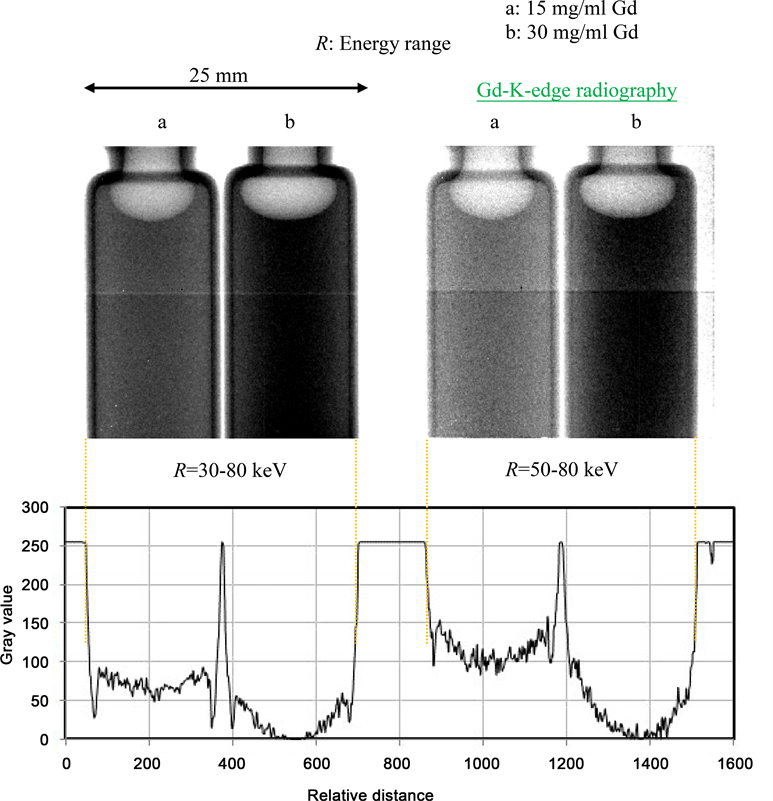 Enhanced KEdge Radiography Using a HighSpatialResolution Cadmium