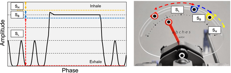 AudioVisual Biofeedback for Respiratory Motion Management Comparison