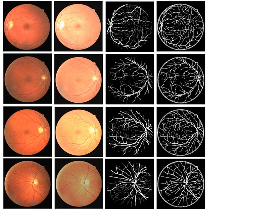 An Improved Method for Automatic Retinal Blood Vessel Vascular