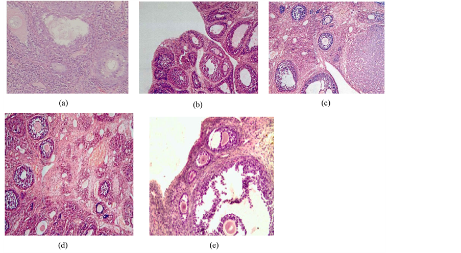 The Effect of Cangfudaotan Tang on Expression of Organic