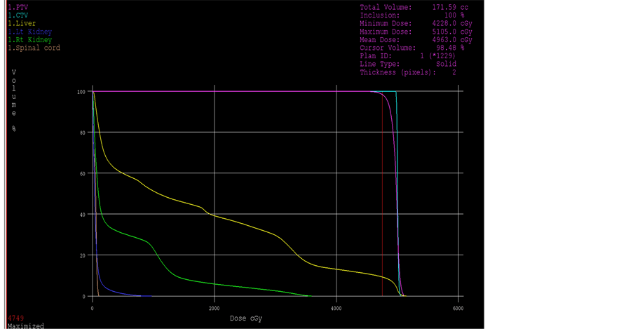 Management of Hepatocellular Carcinoma Patients with