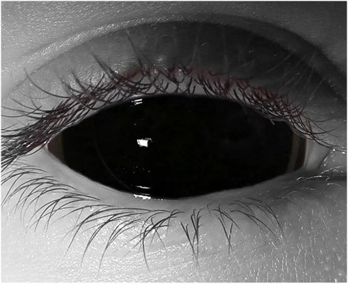 Lentes De Contacto Black Sclera Negros 22Mm (Unidad) | Envío Gratis