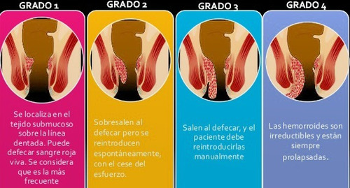 Formula Oficinal Para Hemorroides Garantizada. Mercado Libre