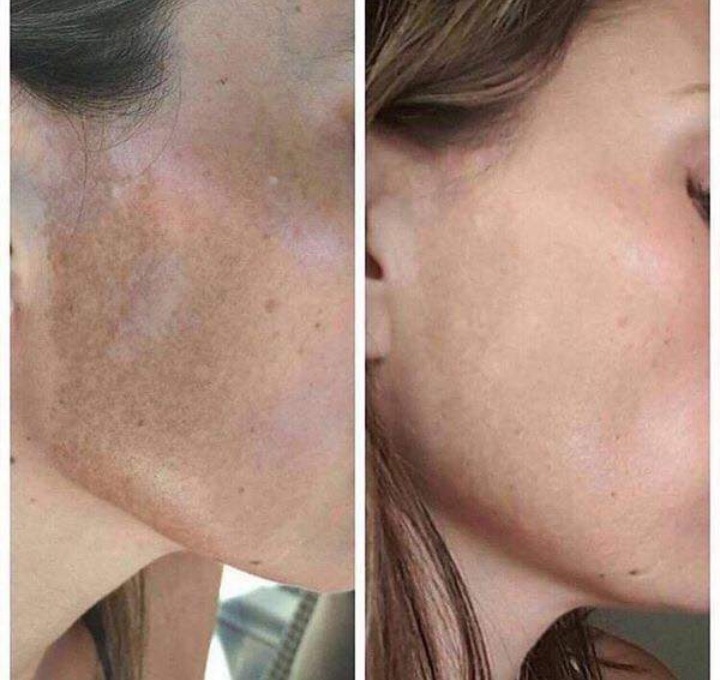 Crema Dermolimpiadora Y Despigmentante Nu Skin Face Wash Mercado Libre