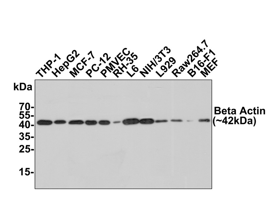 Beta Actin Mouse Monoclonal Antibody [A2F6] (EM21002) HUABIO