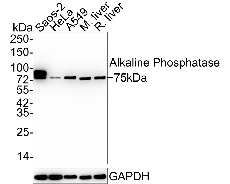 Alkaline Phosphatase Monoclonal Antibody (ET160121) HUABIO